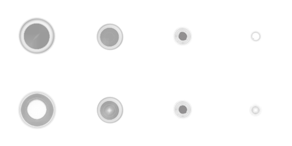 The two kinds of eye floater spheres in transition from the relaxed state (left) to the concentrated state (right).